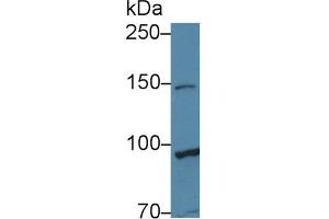 Western Blot; Sample: Human Hela cell lysate; Primary Ab: 1µg/ml Rabbit Anti-Human TAF2 Antibody Second Ab: 0. (TAF2 antibody  (AA 918-1199))