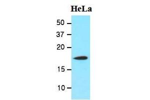 Western Blotting (WB) image for anti-Cofilin 1 (CFL1) (AA 1-166), (N-Term) antibody (ABIN336102) (Cofilin antibody  (N-Term))