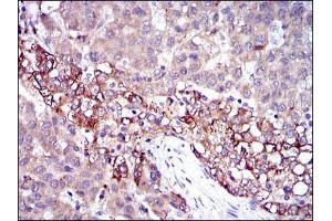 Immunohistochemistry (IHC) image for anti-Fibrinogen gamma Chain (FGG) antibody (ABIN969142)