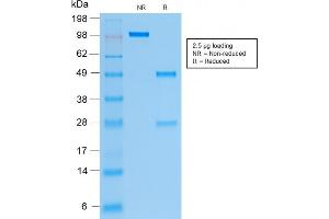 SDS-PAGE (SDS) image for anti-Keratin 19 (KRT19) antibody (ABIN6939940)