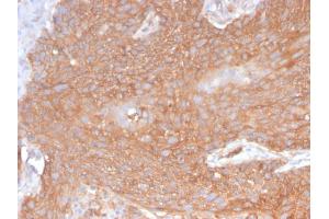 Immunohistochemistry (IHC) image for anti-Spectrin, Beta, Non-erythrocytic 2 (SPTBN2) (AA 356-475) antibody (ABIN6940656)