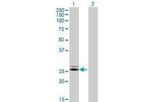 Lane 1: GRPEL2 transfected lysate ( 25. (GRPEL2 293T Cell Transient Overexpression Lysate(Denatured))