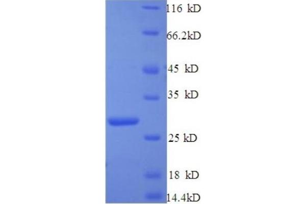 C1ql1 Protein (AA 17-258) (His tag)