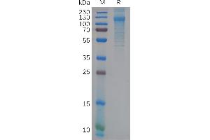 Human F Protein, His Tag on SDS-PAGE under reducing condition. (FCRL5 Protein (AA 16-850) (His tag))