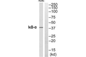 Western Blotting (WB) image for anti-Nuclear Factor of kappa Light Polypeptide Gene Enhancer in B-Cells Inhibitor, alpha (NFKBIA) (N-Term) antibody (ABIN1849268) (NFKBIA antibody  (N-Term))