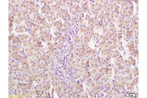 Immunohistochemistry (Paraffin-embedded Sections) (IHC (p)) image for anti-Growth Hormone Receptor (GHR) (AA 101-200) antibody (ABIN671481)