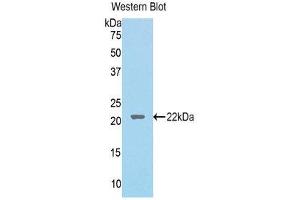 Western Blotting (WB) image for anti-Lecithin-Cholesterol Acyltransferase (LCAT) (AA 41-210) antibody (ABIN1176768) (LCAT antibody  (AA 41-210))