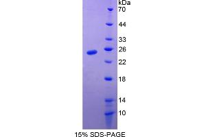 Image no. 1 for High Mobility Group Box 2 (HMGB2) (AA 2-187) protein (His tag) (ABIN4988997) (HMGB2 Protein (AA 2-187) (His tag))