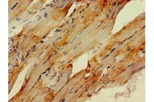 Immunohistochemistry of paraffin-embedded human skeletal muscle tissue using ABIN7151009 at dilution of 1:100 (STUB1 antibody  (AA 1-48))