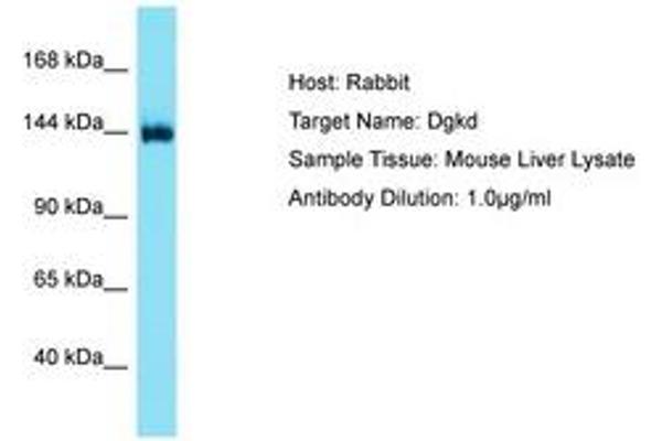 DGKD 抗体  (AA 449-498)