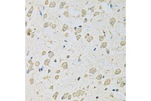 Immunohistochemistry of paraffin-embedded mouse brain using PSMC2 antibody. (PSMC2 antibody)