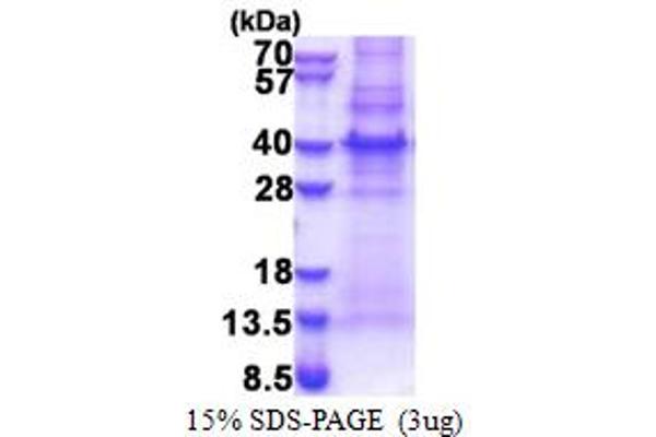 MLF1IP Protein (AA 147-418) (His tag)