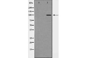 Western blot analysis of CDH2 expression in Jurkat cells,The lane on the left is treated with the antigen-specific peptide. (N-Cadherin antibody  (C-Term))