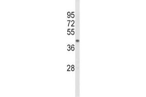 Western blot analysis of ACADL antibody and mouse kidney tissue lysate. (ACADL antibody  (AA 292-319))