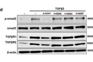 Western Blotting (WB) image for anti-SMAD, Mothers Against DPP Homolog 3 (SMAD3) (AA 417-425), (pSer423), (pSer425) antibody (ABIN129675)