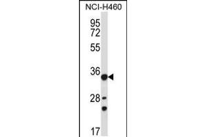 Western blot analysis in NCI-H460 cell line lysates (35ug/lane). (AKR1B10 antibody  (AA 101-130))