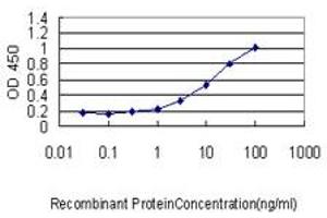 Detection limit for recombinant GST tagged VSNL1 is approximately 0. (VSNL1 antibody  (AA 1-191))