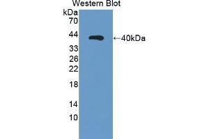 Detection of Recombinant NR3C1, Human using Polyclonal Antibody to Retinaldehyde Binding Protein 1 (RLBP1) (RLBP1 antibody)