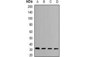 Western blot analysis of HMGCL expression in SKOV3 (A), MCF7 (B), mouse liver (C), mouse kidney (D) whole cell lysates. (HMGCL antibody)