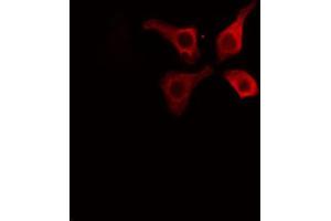ABIN6267595 staining HuvEc cells by IF/ICC. (Caveolin-1 antibody  (pTyr14))