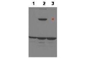 Western blot using  affinity purified anti-ASPP1 to detect over-expressed ASPP1 in MCF-7 cells (lane 2, arrowhead). (PPP1R13B antibody  (Internal Region))