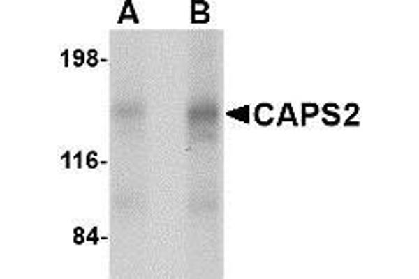 CADPS2 antibody  (Center)