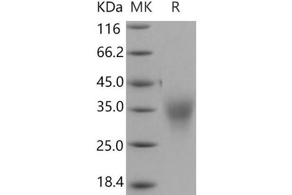 ACVR2B Protein (His tag)