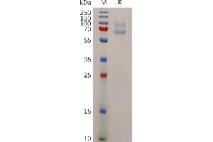 ADAM28 Protein (AA 19-664) (His tag)