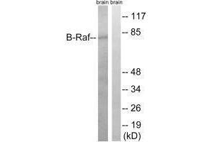 Western blot analysis of extracts from rat brain cells, using B-Raf (Ab-753) antibody. (BRAF antibody  (Thr735))