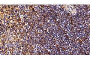 Detection of CD4 in Human Spleen Tissue using Polyclonal Antibody to Cluster Of Differentiation 4 (CD4) (CD4 antibody  (AA 26-396))