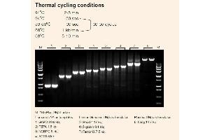 Image no. 1 for TransStart® KD Plus DNA Polymerase (ABIN5519545)