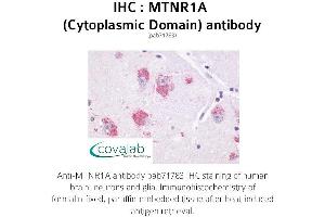 Image no. 1 for anti-Melatonin Receptor 1A (MTNR1A) (1st Cytoplasmic Domain) antibody (ABIN1737115) (Melatonin Receptor 1A antibody  (1st Cytoplasmic Domain))