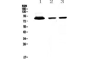 Western blot analysis of Lactoferrin using anti-Lactoferrin antibody . (Lactoferrin antibody  (AA 529-710))