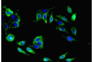 Immunofluorescent analysis of Hela cells using ABIN7161238 at dilution of 1:100 and Alexa Fluor 488-congugated AffiniPure Goat Anti-Rabbit IgG(H+L) (Neuritin 1-Like antibody  (AA 1-165))