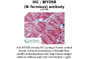 Image no. 1 for anti-Myosin VB (MYO5B) antibody (ABIN1737170) (MYO5B antibody)