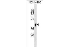 Western blot analysis in NCI-H460 cell line lysates (35ug/lane). (QPCTL antibody  (C-Term))