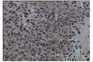 Immunohistochemistry (IHC) image for anti-Jagged 1 (JAG1) (Internal Region) antibody (ABIN129524)