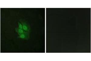 Immunofluorescence analysis of HeLa cells, using p53 (Phospho-Ser392) Antibody. (p53 antibody  (pSer392))