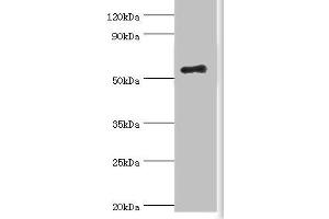 Western blot All lanes: Zinc finger protein Aiolos antibody at 8 μg/mL + HepG2 whole cell lysate Secondary Goat polyclonal to rabbit IgG at 1/10000 dilution Predicted band size: 59, 52, 54, 30, 48, 50, 55, 42, 36, 33, 43, 31 kDa Observed band size: 59 kDa (IKZF3 antibody  (AA 280-450))