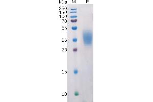 Human Protein, His Tag on SDS-PAGE under reducing condition. (PDCD1LG2 Protein (AA 20-219) (His tag))
