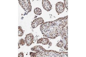 Immunohistochemistry (Paraffin-embedded Sections) (IHC (p)) image for anti-BRCA1 Associated Protein-1 (Ubiquitin Carboxy-terminal Hydrolase) (BAP1) (AA 36-66) antibody (ABIN388948)