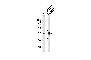 Western blot analysis of lysates from human placenta and heart tissue lysates (from left to right), using FRAT2 Antibody at 1:1000 at each lane. (FRAT2 antibody  (C-Term))