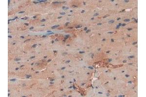 IHC-P analysis of Human Heart Tissue, with DAB staining. (Haptoglobin antibody  (AA 70-332))