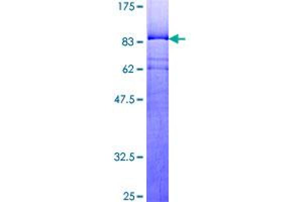 YY1 Protein (AA 1-414) (GST tag)