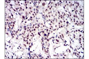 Fig. (CTNNBL1 antibody  (AA 390-557))