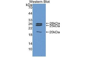 Western Blotting (WB) image for anti-Catalase (CAT) (AA 246-366) antibody (ABIN3201712) (Catalase antibody  (AA 246-366))