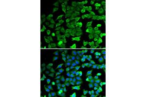 Immunofluorescence (IF) image for anti-Sirtuin 2 (SIRT2) (AA 288-389) antibody (ABIN6213756) (SIRT2 antibody  (AA 288-389))