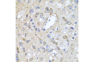 Immunohistochemistry of paraffin-embedded rat brain using CXCR4 antibody at dilution of 1:100 (x40 lens). (CXCR4 antibody)