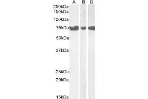 ABIN570944 (1µg/ml) staining of Human Pancreas (A), Heart (B) and Skeletal Muscle (C) lysates (35µg protein in RIPA buffer). (ITPKC antibody  (Internal Region))