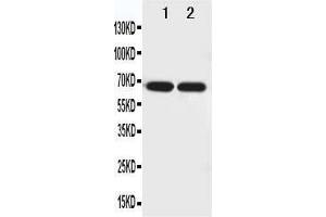 Anti-Netrin 1 antibody, Western blotting Lane 1: U87 Cell Lysate Lane 2: COLO320 Cell Lysate (Netrin 1 antibody  (N-Term))